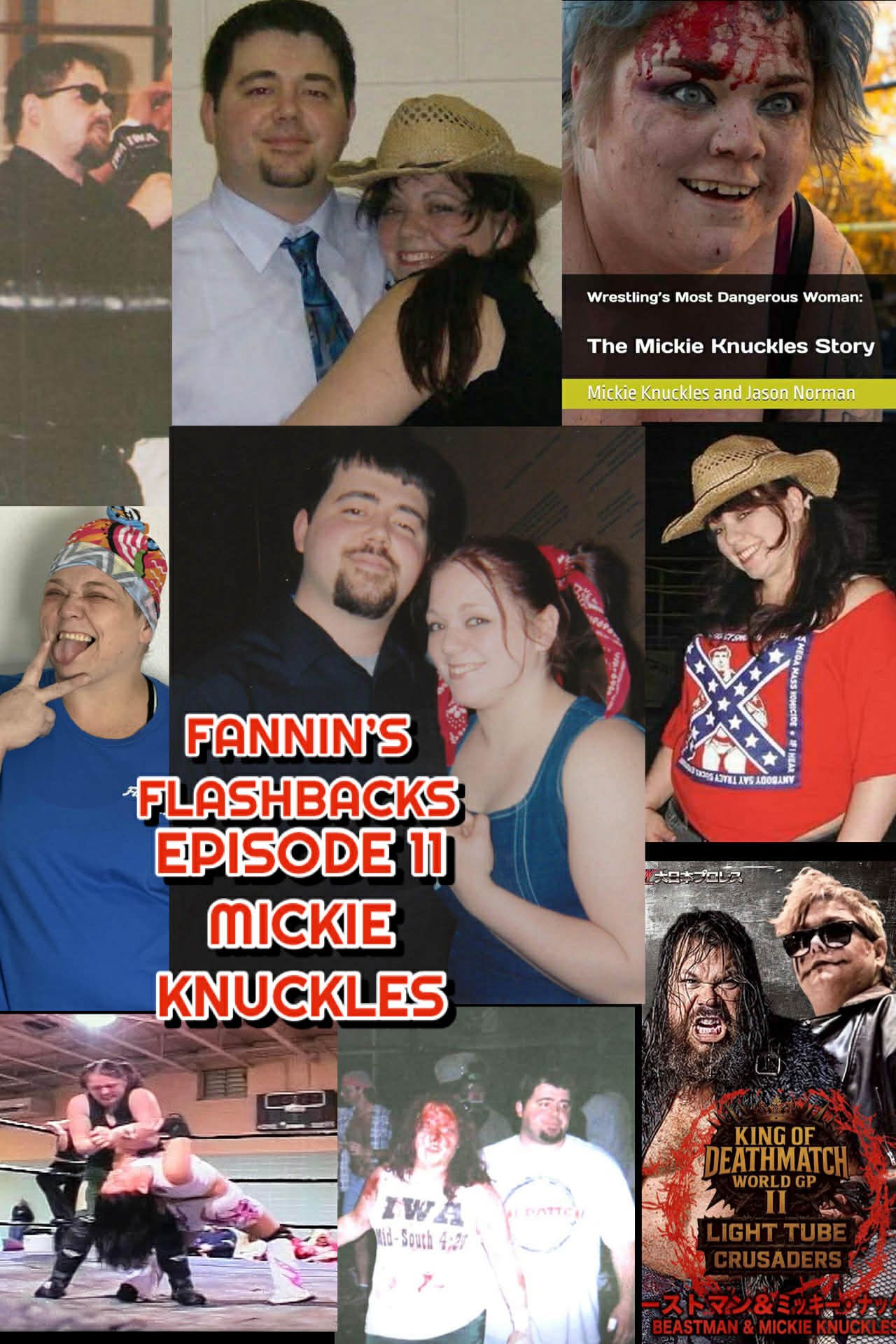 Fannin’s Flashbacks – Audio Only – Episode 11 – Mickie Knuckles